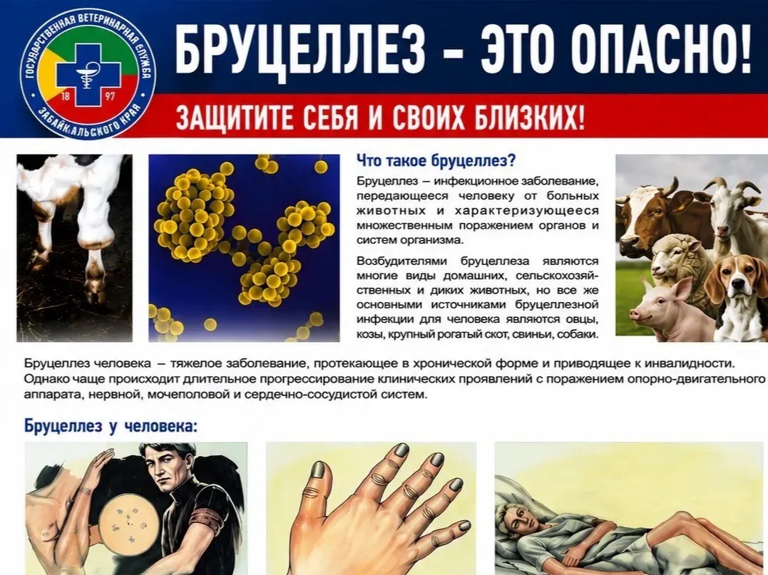 Бруцеллез, памятка.